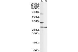 Image no. 1 for anti-Pre-mRNA Processing Factor 31 (PRPF31) (Internal Region) antibody (ABIN375228) (PRPF31 anticorps  (Internal Region))
