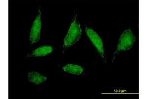 Immunofluorescence of purified MaxPab antibody to CHCHD3 on HeLa cell.