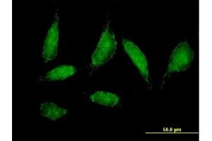 Immunofluorescence of purified MaxPab antibody to CHCHD3 on HeLa cell. (CHCHD3 anticorps  (AA 1-227))