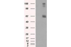 HEK293T cells were transfected with the pCMV6-ENTRY control (Left lane) or pCMV6-ENTRY LIPG (Right lane) cDNA for 48 hrs and lysed. (LIPG anticorps)