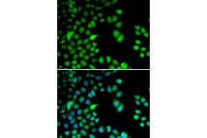 Immunofluorescence analysis of HeLa cells using RPS6KA3 antibody (ABIN5973157). (RPS6KA3 anticorps)