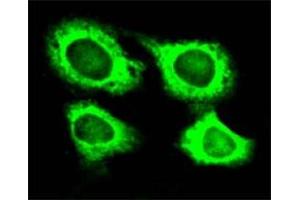 Immunofluorescence of HeLa cell line with WARS polyclonal antibody . (WARS anticorps)