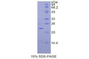 SDS-PAGE (SDS) image for Sirtuin 3 (SIRT3) (AA 127-303) protein (His tag) (ABIN2122092)