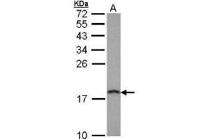 WB Image Sample (30 ug of whole cell lysate) A: Hep G2 , 12% SDS PAGE antibody diluted at 1:1000 (PFDN5 anticorps)