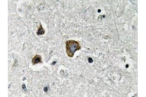 Immunohistochemistry analyzes of BNIP-3 antibody in paraffin-embedded human brain tissue. (BNIP3 anticorps)