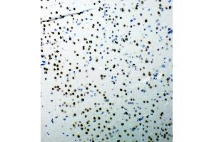 Anti-53BP1 antibody, IHC(P) IHC(P): Rat Brain Tissue