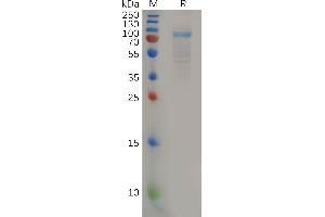 Human IL11RA Protein, hFc Tag on SDS-PAGE under reducing condition.