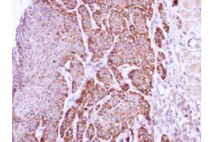 IHC-P Image Immunohistochemical analysis of paraffin-embedded Cal27 xenograft, using arginase I , antibody at 1:500 dilution.