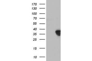 Western Blotting (WB) image for anti-Homeobox C11 (HOXC11) (AA 1-304) antibody (ABIN1490737) (HOXC11 anticorps  (AA 1-304))