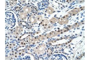 IGSF1 antibody was used for immunohistochemistry at a concentration of 4-8 ug/ml to stain Epithelial cells of renal tubule (arrows) in Human Kidney.