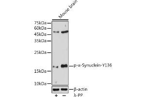 Western blot analysis of extracts of Mouse brain, using Phospho-α-Synuclein-Y136 antibody (ABIN3019943, ABIN3019944, ABIN3019945, ABIN1682064 and ABIN1682065) at 1:1000 dilution. (SNCA anticorps  (pTyr136))