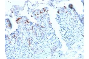 Formalin-fixed, paraffin-embedded human Small Intestine stained with CD209 Recombinant Rabbit Monoclonal Antibody (C209/2749R). (Recombinant DC-SIGN/CD209 anticorps)