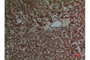 Immunohistochemistry (IHC) analysis of paraffin-embedded Human Liver, antibody was diluted at 1:100. (Cathepsin L anticorps  (Internal Region))