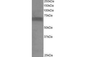Western Blotting (WB) image for anti-Ribosomal Protein S6 Kinase, 70kDa, Polypeptide 1 (RPS6KB1) (C-Term) antibody (ABIN2465296) (RPS6KB1 anticorps  (C-Term))