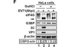 EV71 infection blocks tSG formation independent of 3C. (beta Actin anticorps)