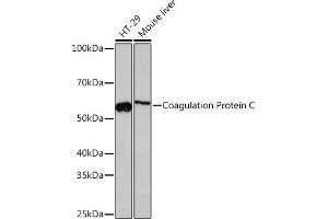 Western blot analysis of extracts of various cell lines, using Coagulation Coagulation Protein C Rabbit mAb (ABIN7271333) at 1:1000 dilution. (PROC anticorps)