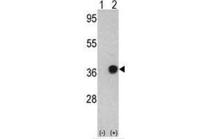 Western blot analysis of NPM1 (arrow) using rabbit polyclonal NPM1 Antibody (C-term) . (NPM1 anticorps  (C-Term))
