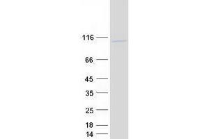 Validation with Western Blot