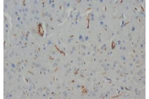 Immunohistochemistry (IHC) image for anti-Neurofilament, Heavy Polypeptide (NEFH) (C-Term) antibody (ABIN1108414)
