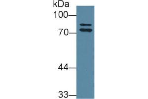 Western Blot; Sample: Rat Liver lysate; Primary Ab: 1µg/ml Rabbit Anti-Rat OS9 Antibody Second Ab: 0. (OS9 anticorps  (AA 465-666))