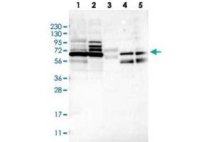 Western blot analysis of Lane 1: RT-4, Lane 2: U-251 MG, Lane 3: Human Plasma, Lane 4: Liver, Lane 5: Tonsil with MUM1L1 polyclonal antibody . (MUM1L1 anticorps)