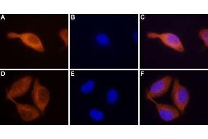 Expression of STIM2 in RBL cells - Immunocytochemical staining of paraformaldehyde-fixed and permeabilized rat basophilic leukemia (RBL) cells.
