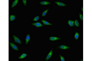 Immunofluorescent analysis of Hela cells using ABIN7167611 at dilution of 1:100 and Alexa Fluor 488-congugated AffiniPure Goat Anti-Rabbit IgG(H+L)