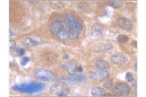 Image no. 2 for anti-Interleukin 6 (IL6) antibody (ABIN181728)