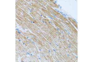 Immunohistochemistry of paraffin-embedded mouse heart using CCL2 antibody (ABIN4903158) at dilution of 1:100 (40x lens). (CCL2 anticorps)