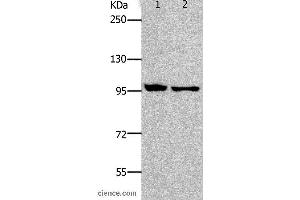 Western blot analysis of HT-29 and SKOV3 cell, using NFKB2 Polyclonal Antibody at dilution of 1:800 (NFKB2 anticorps)