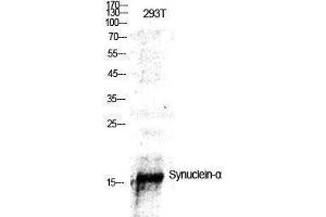 Western Blotting (WB) image for anti-Synuclein, alpha (SNCA) (Tyr1112) antibody (ABIN3177574) (SNCA anticorps  (Tyr1112))