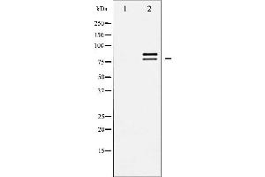 Western blot analysis of HSL expression in CalyculinA treated HeLa whole cell lysates,The lane on the left is treated with the antigen-specific peptide. (LIPE anticorps  (Internal Region))