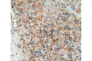 Used in DAB staining on fromalin fixed paraffin- embedded kidney cancer tissue (TOR1AIP2 anticorps  (AA 249-476))