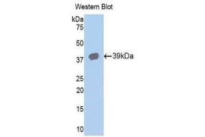 Western Blotting (WB) image for anti-Keratin 15 (KRT15) (AA 94-402) antibody (ABIN1173001)