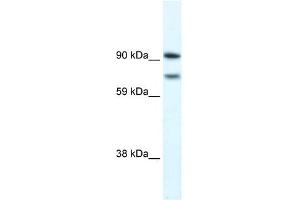 WB Suggested Anti-ZFHX1B Antibody Titration: 0. (ZEB2 anticorps  (N-Term))