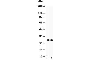 Western blot testing of VEGF antibody (A isoform) and Lane 1:  rat thymus;  2: rat brain lysate (VEGFA anticorps  (AA 27-191))