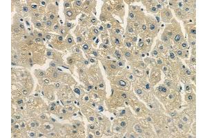 ABIN6259298 and ABIN6275279 at 1/100 staining human normal liver tissue by IHC-P.