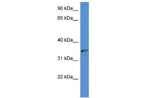 WB Suggested Anti-SORD AntibodyTitration: 1. (SORD anticorps  (N-Term))