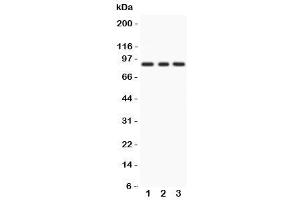 Western blot testing of PKC epsilon antibody and Lane 1:  rat brain (PKC epsilon anticorps  (AA 53-236))