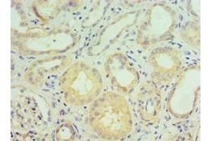 Immunohistochemistry of paraffin-embedded human kidney tissue using ABIN7143467 at dilution of 1:100