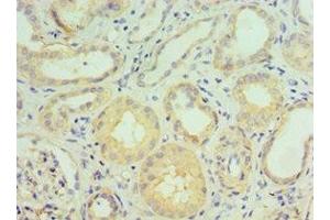 Immunohistochemistry of paraffin-embedded human kidney tissue using ABIN7143467 at dilution of 1:100 (GGA2 anticorps  (AA 1-300))