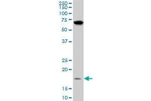 NDUFB11 monoclonal antibody (M08), clone 4B2.