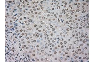 Image no. 1 for anti-Cancer/testis Antigen 1B (CTAG1B) antibody (ABIN1499899) (CTAG1B anticorps)
