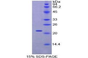 SDS-PAGE (SDS) image for Centromere Protein E, 312kDa (CENPE) (AA 2222-2361) protein (His tag) (ABIN1879012)