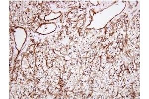 Immunohistochemistry (IHC) image for anti-Clusterin (CLU) (AA 1-333), (N-Term) antibody (ABIN317504)