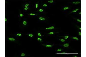 Immunofluorescence of monoclonal antibody to OXSR1 on HeLa cell.