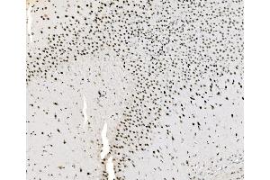 IHC analysis of JUNB using anti-JUNB antibody (ABIN7603223). (JunB anticorps  (N-Term))