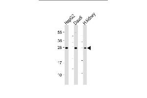 All lanes : Anti-HAVCR2 Antibody at 1:4000 dilution Lane 1: HepG2 whole cell lysate Lane 2: Daudi whole cell lysate Lane 3: Human kidney lysate Lysates/proteins at 20 μg per lane. (TIM3 anticorps)
