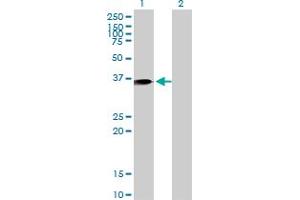 Western Blot analysis of ANXA1 expression in transfected 293T cell line by ANXA1 monoclonal antibody (M10), clone 2D11. (Annexin a1 anticorps  (AA 1-346))