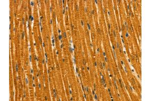 Phospho-RAB7L1 (Thr71) Antibody at 1/100 staining Rat heart tissue by IHC-P. (RAB7L1 anticorps  (pThr71))